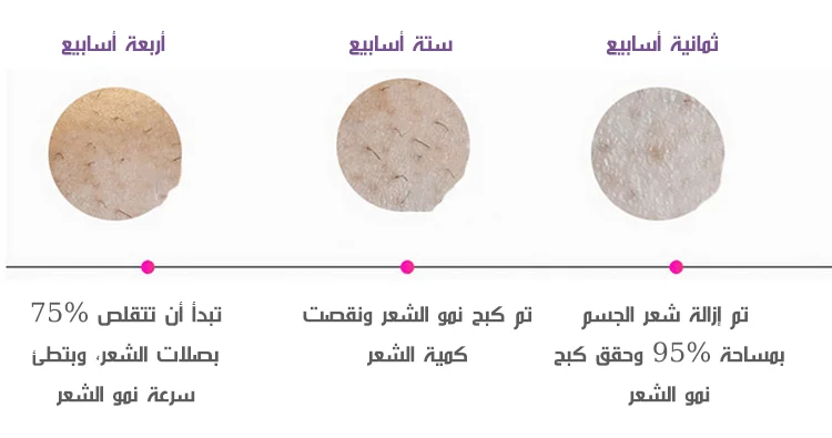 جهاز إزالة الشعر بالليزر